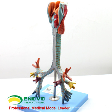 LUNG05(12502) 2 parts Life Size Larynx ,Trachea & Bronchial Tree Anatomy Models > Respiratory